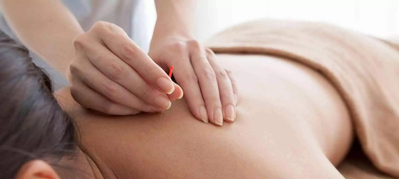 Painless Acupuncture Practice