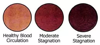 Cupping Colour Meaning